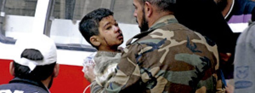 Niño herido durante un ataque en Homs, Siria