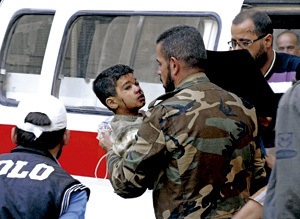 Niño herido durante un ataque en Homs, Siria