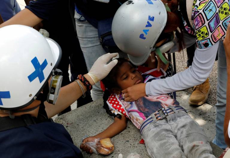 Venezuela niña sufre efectos de gas lacrimógeno durante una protesta en Caracas contra el