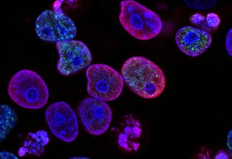 Células cancerígenas