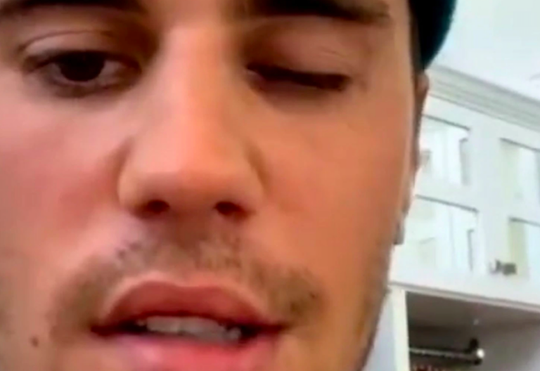 Justin Bieber se apunta al “y recen por mí” para superar su enfermedad
