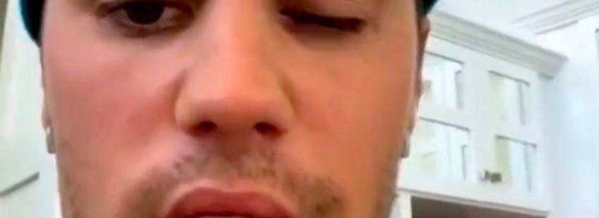 Justin Bieber se apunta al “y recen por mí” para superar su enfermedad
