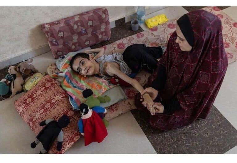 Joven en desnutrición