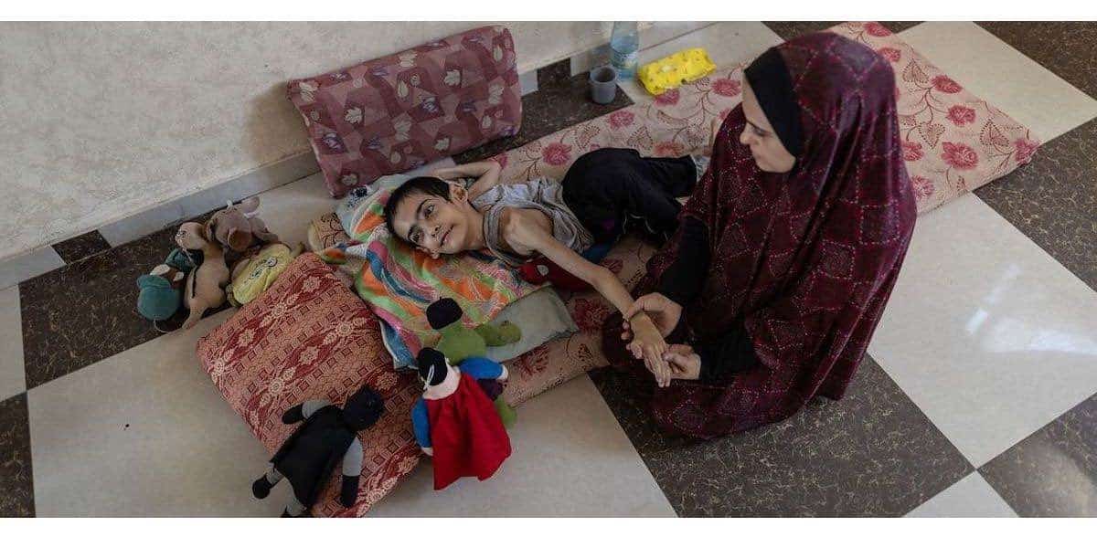 Joven en desnutrición