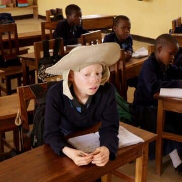 Niño con albinismo en Tanzania