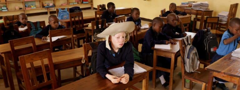Niño con albinismo en Tanzania