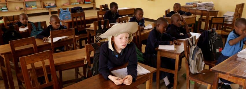 Niño con albinismo en Tanzania